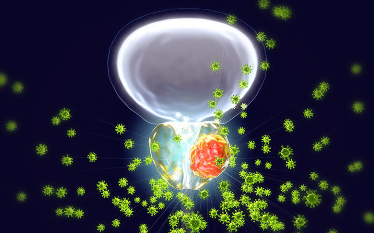 Tratamento de Câncer de Próstata